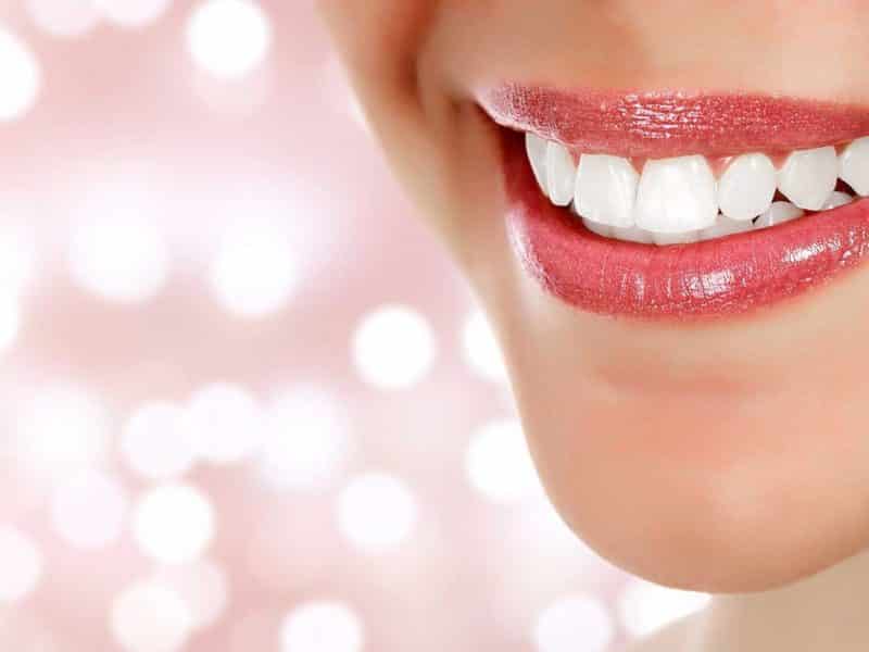 Gülüş Estetiği İçin Diş Bakımı Ve Tedavisi