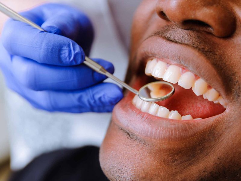 Eryaman Diş Sağlığı Hizmetleri Ve Avantajlı Sonuçlar
