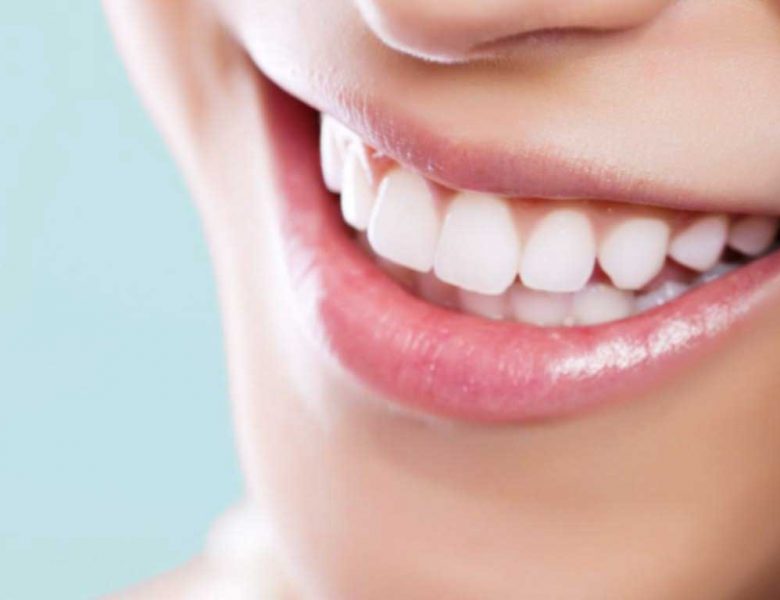 20 Yaş Dişleri Ameliyatla Mı Çekilir?